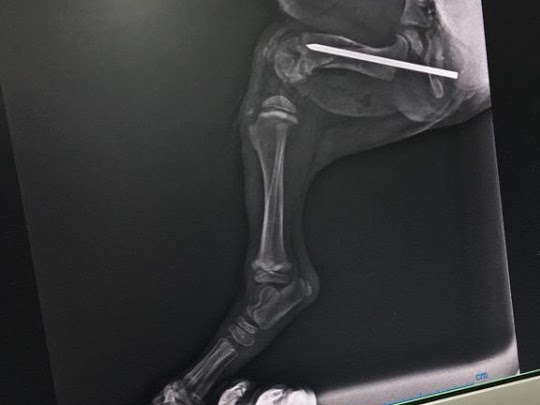 FEMUR KIRII