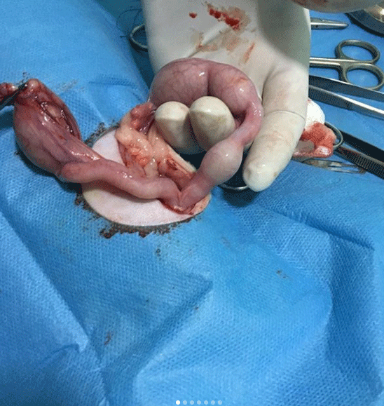 PYOMETRA